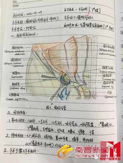90后美女护士手术笔记走红 字迹工整解剖图手绘